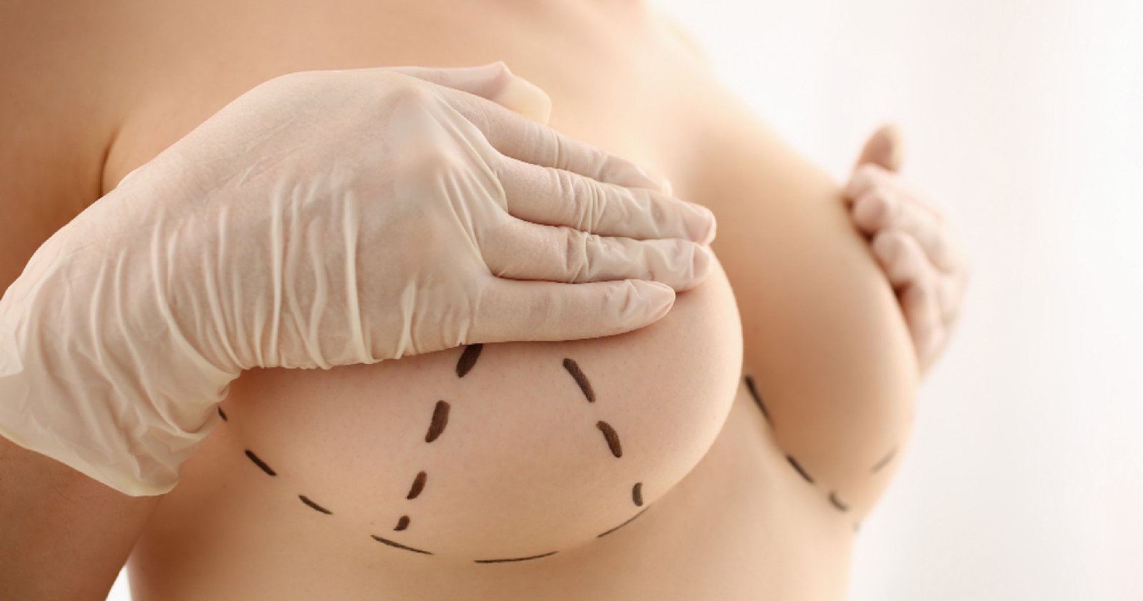 Best Cosmetic Surgeon In Bangalore